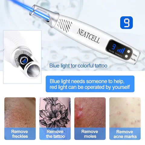 AstraGlow Home Laser Pen For Tattoo, Mole And Freckle Removal