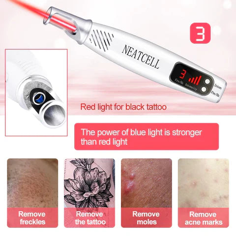 AstraGlow Home Laser Pen For Tattoo, Mole And Freckle Removal