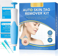Liver Spot Removal - Removal of Birthmark