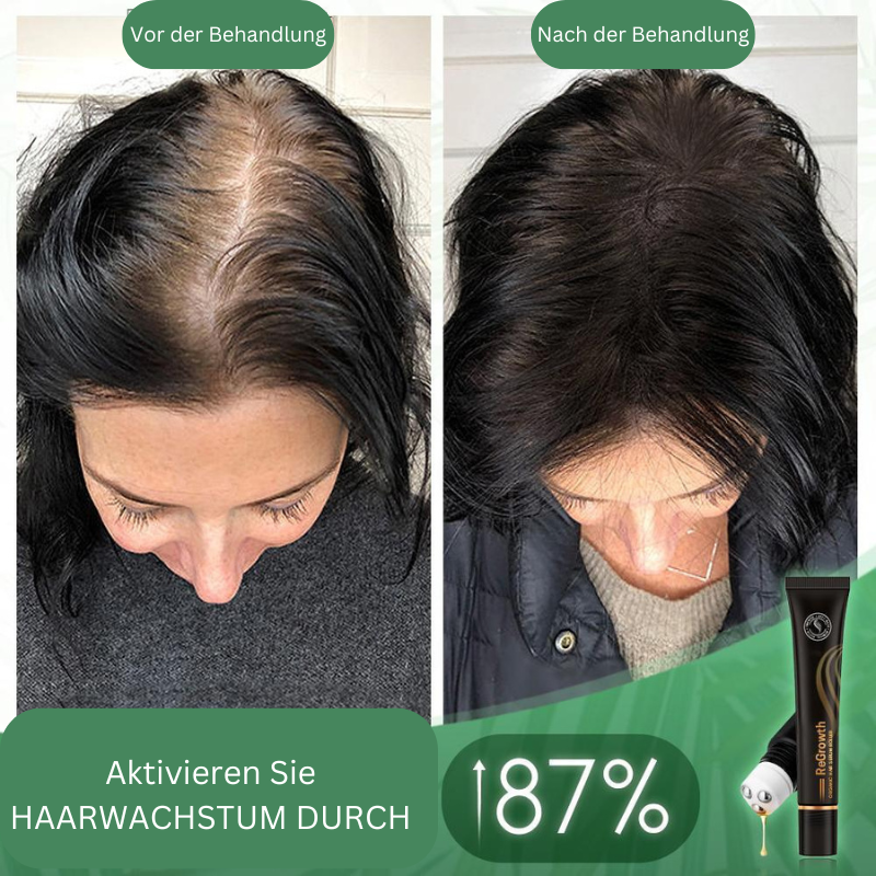 Regrowth Bio-Hair-Serum-Roller (1+1 free)