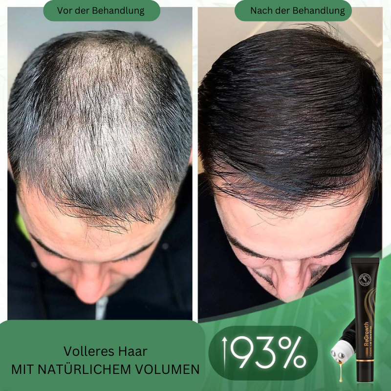 Regrowth Bio-Hair-Serum-Roller (1+1 free)