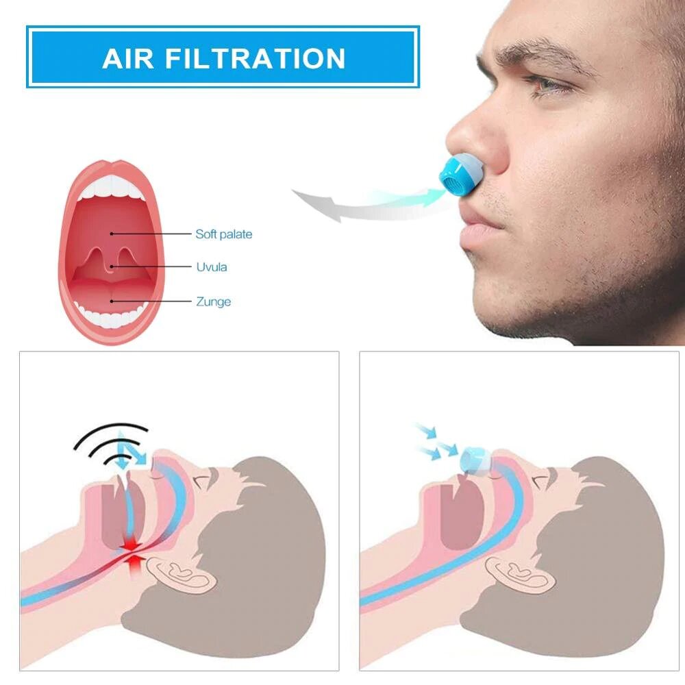 Wearclo | Anti-Snoring Device | Tubeless, Maskless Micro-CPAP