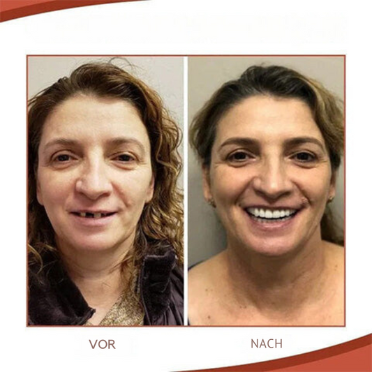 Wearclo | Biocompatible Silicone Prosthesis Set for Pain-Free Fit and Natural Smile
