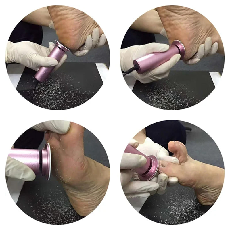 Wearclo | Electric Foot File for Smooth Feet | Callus Remover Tool