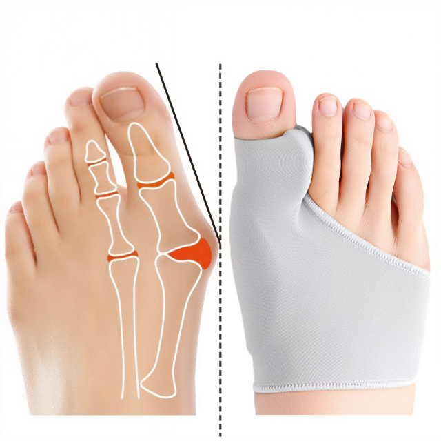 Wearclo | Gel Bunion Corrector Sock for Foot Pain Relief