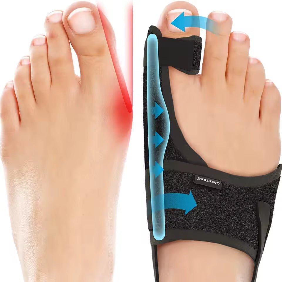 Wearclo | Night Splint Hallux Valgus - Ergonomic and Adjustable Comfort
