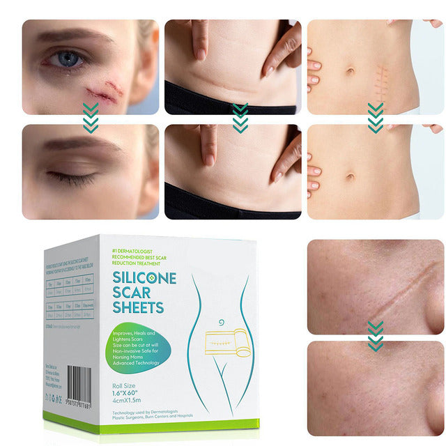 Wearclo | Silicone Scar Tape Roll