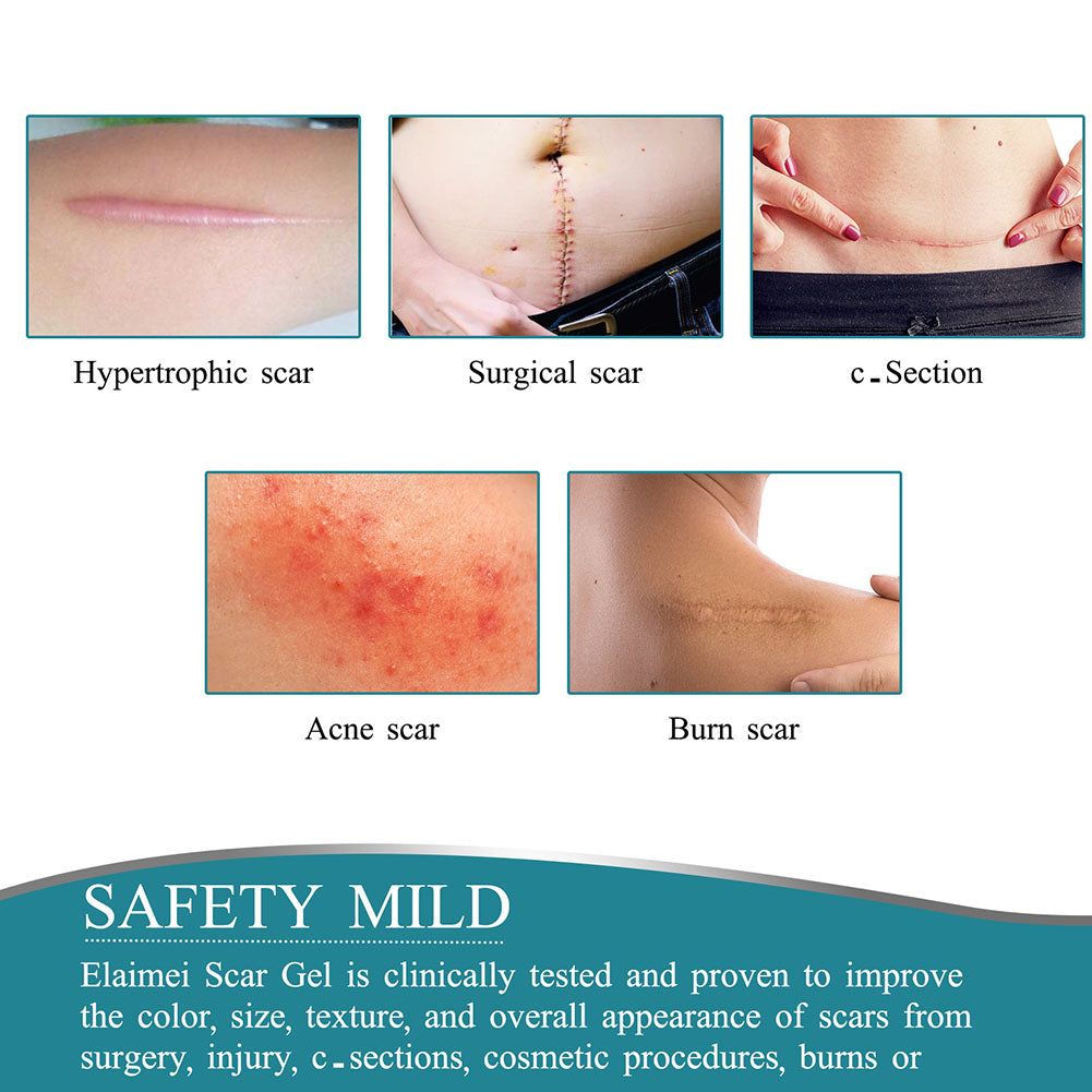 Wearclo | Silicone Scar Tape Roll