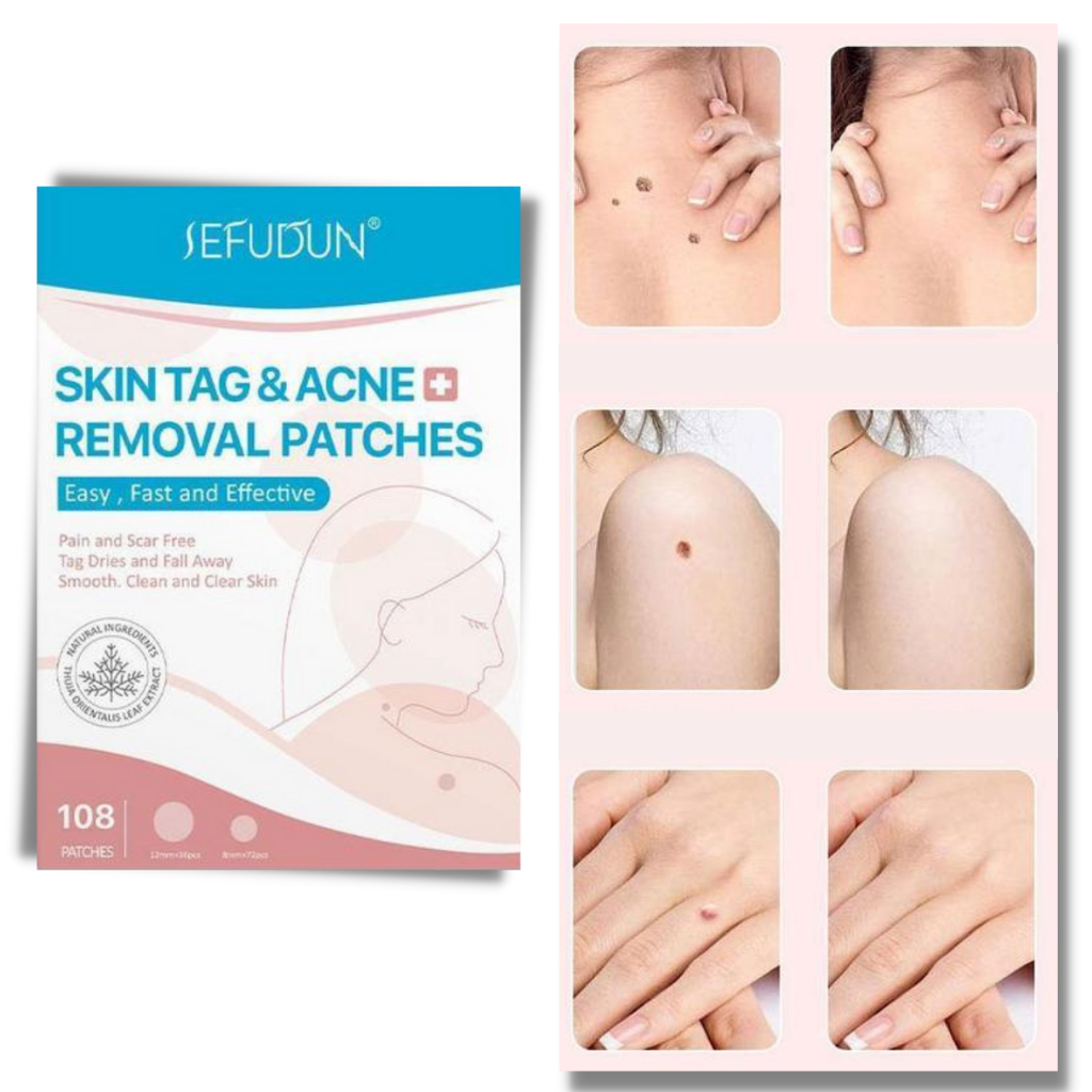 Wearclo | Skin Patch - Remove moles and warts naturally!