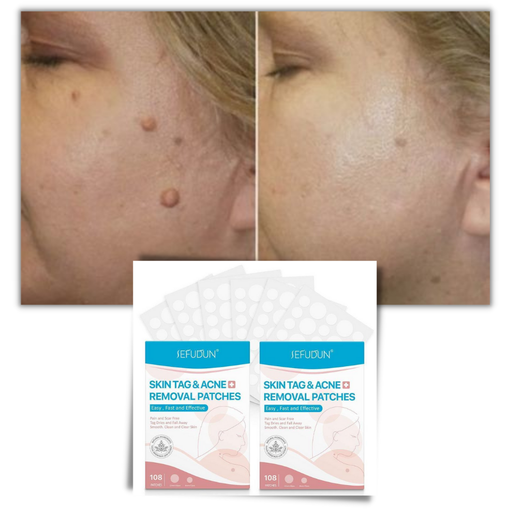 Wearclo | Skin Patch - Remove moles and warts naturally!