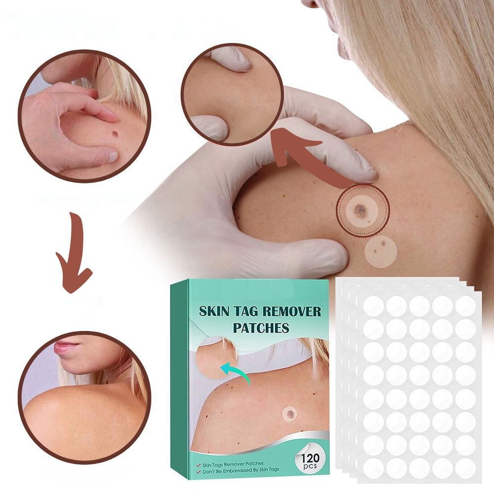 Wearclo | SkinClear Skin Tag Remover | Plaster for the Removal of Skin Tags & Warts | Hydrocolloid Technology | Pain-Free & Discreet | For All Skin Types | 144 Pieces