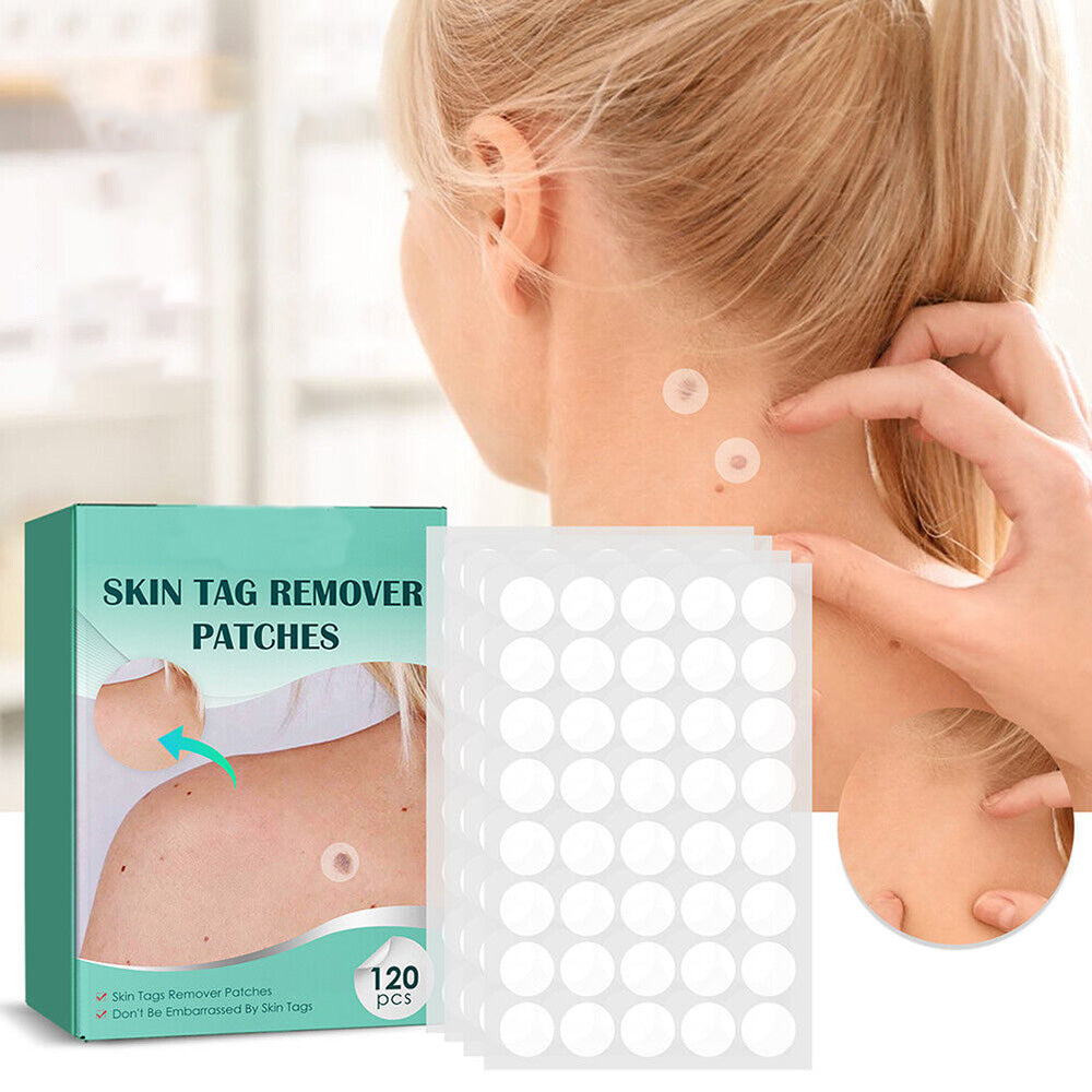 Wearclo | SkinClear Skin Tag Remover | Plaster for the Removal of Skin Tags & Warts | Hydrocolloid Technology | Pain-Free & Discreet | For All Skin Types | 144 Pieces