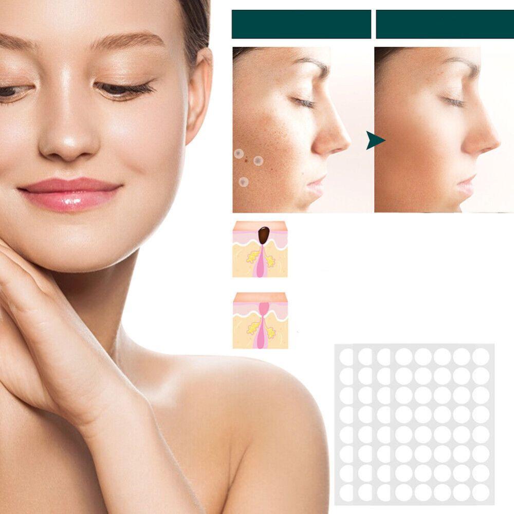 Wearclo | SkinClear Skin Tag Remover | Plaster for the Removal of Skin Tags & Warts | Hydrocolloid Technology | Pain-Free & Discreet | For All Skin Types | 144 Pieces
