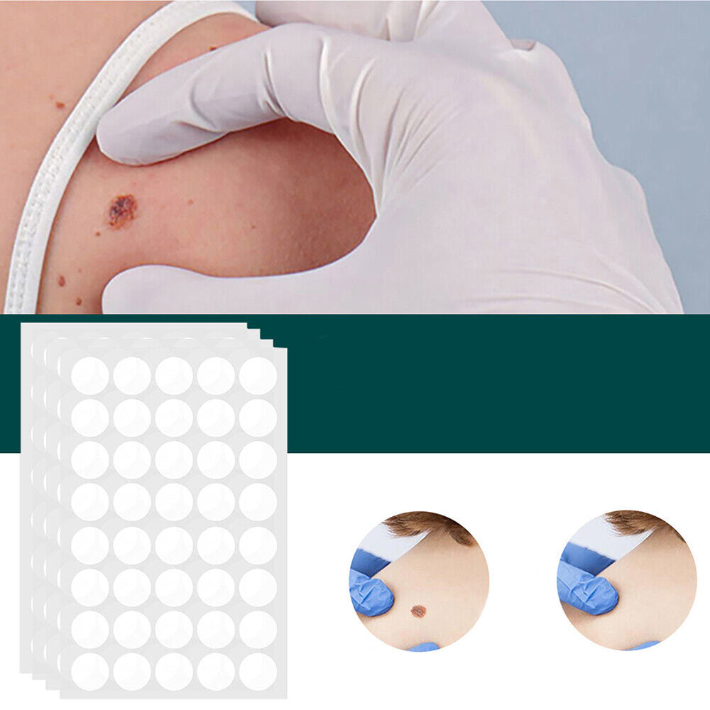 Wearclo | SkinClear Skin Tag Remover | Plaster for the Removal of Skin Tags & Warts | Hydrocolloid Technology | Pain-Free & Discreet | For All Skin Types | 144 Pieces
