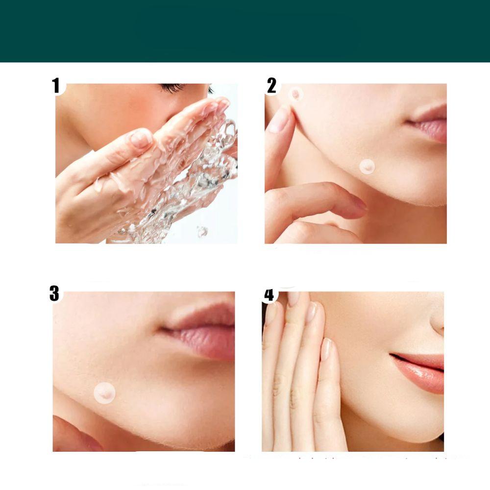 Wearclo | SkinClear Skin Tag Remover | Plaster for the Removal of Skin Tags & Warts | Hydrocolloid Technology | Pain-Free & Discreet | For All Skin Types | 144 Pieces