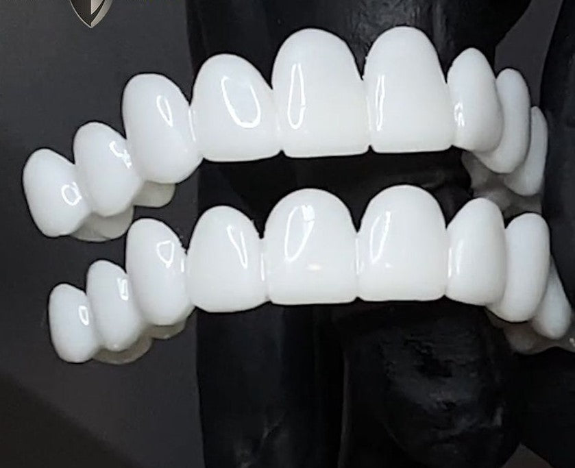 Wearclo | Snap-On Cosmetic Veneers | Instant Smile Cover for Imperfections