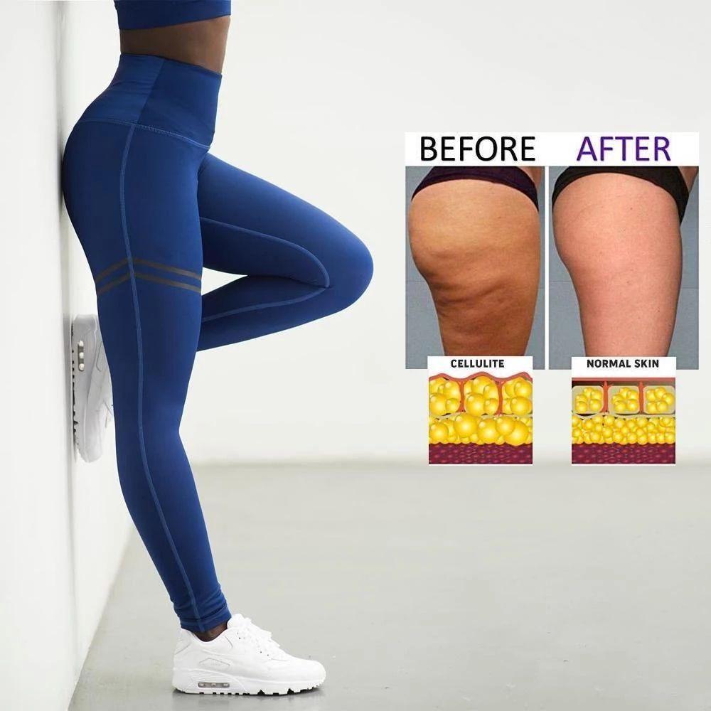 Wearclo | Women's Anti-cellulite Compression Leggings